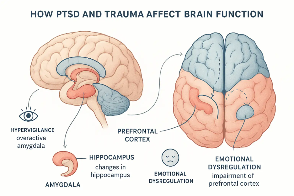 Educational infographic showing side and top views of a human brain highlighting amygdala, hippocampus, and prefrontal cortex. Labeled arrows illustrate PTSD and trauma effects, with concise callouts and symptom icons for hypervigilance, memory disruption, and emotional regulation, set on a clean white background.